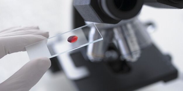 فحص الدم لتشخيص الطفيليات في الجسم