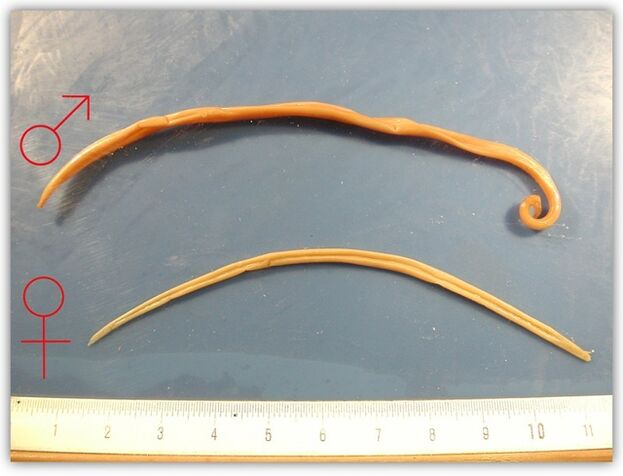 كيف تبدو الديدان المستديرة