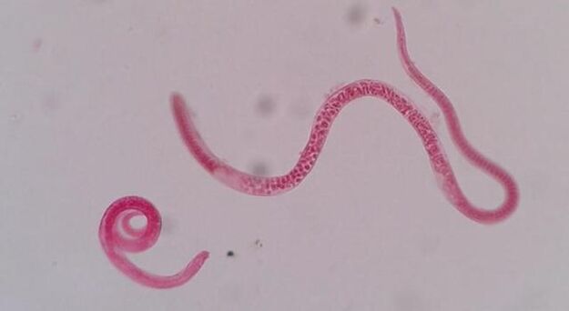 كيف تبدو تريشينيلا؟